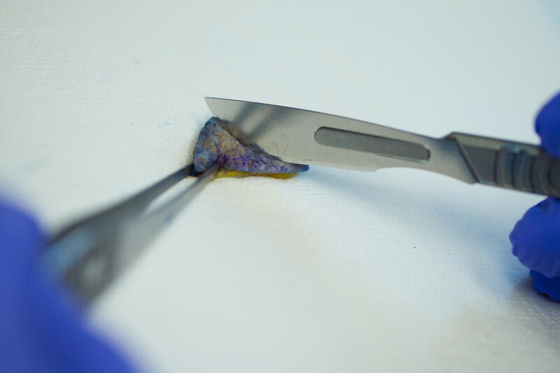 Overnight tissue processing