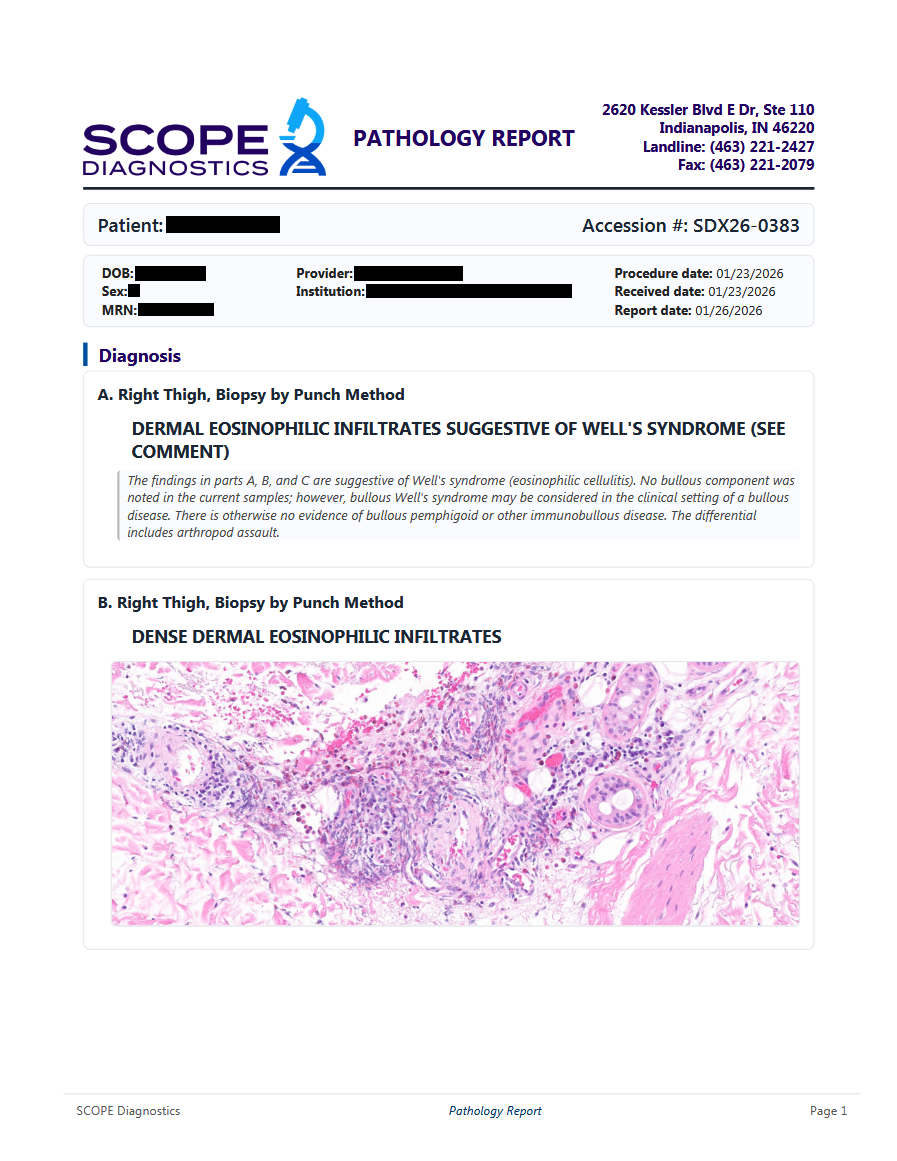Next-day SCOPE Diagnostics pathology report